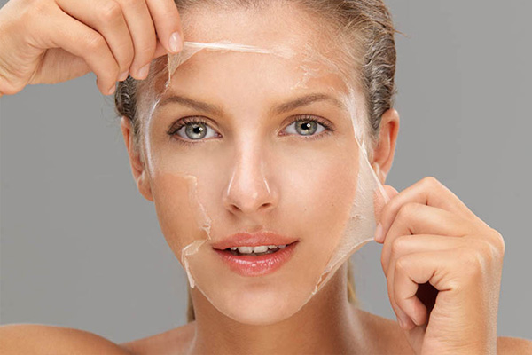 peeling-quimico